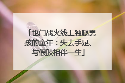 也门战火线上独腿男孩的童年：失去手足、与假肢相伴一生